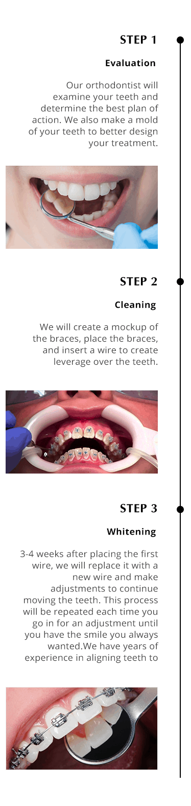 Braces 123