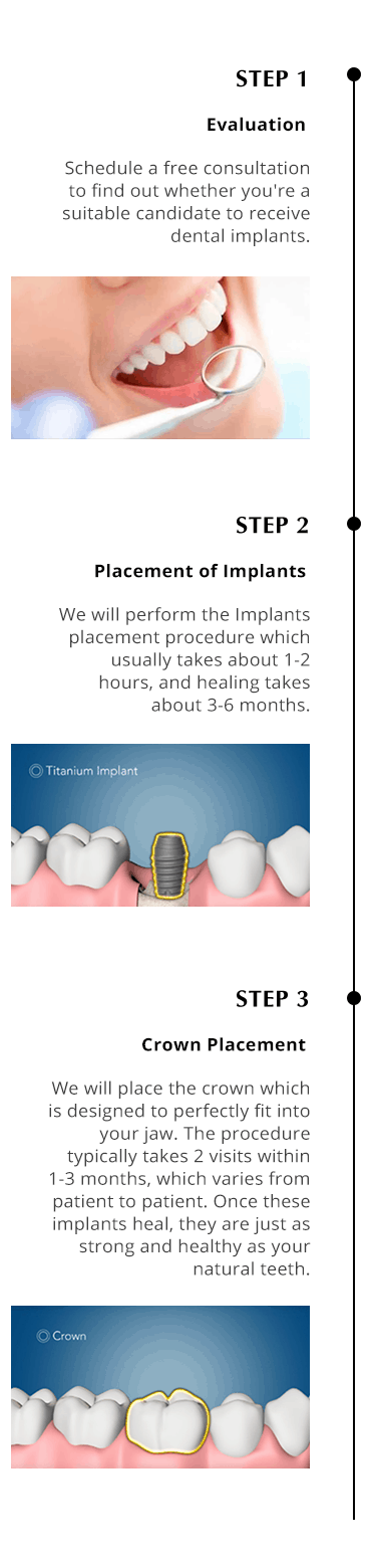 Implants 123